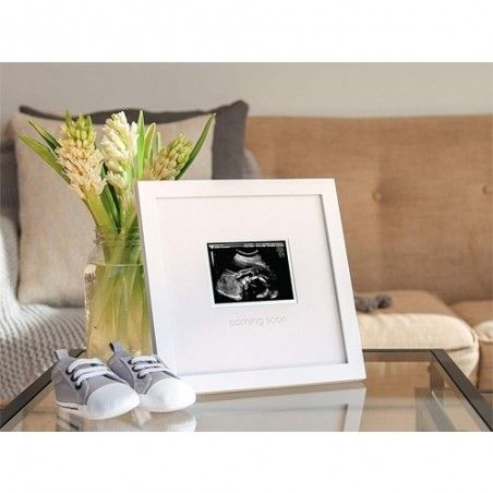 Cadre Sonagramme Souvenir De Grossesse